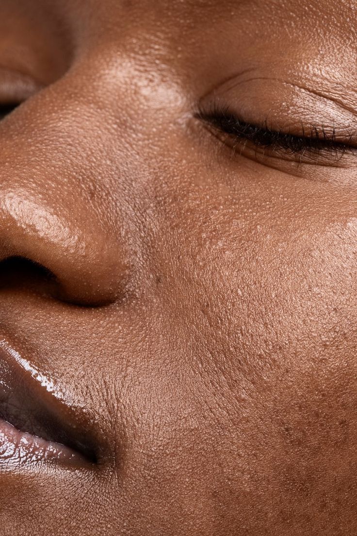 Dry Skin